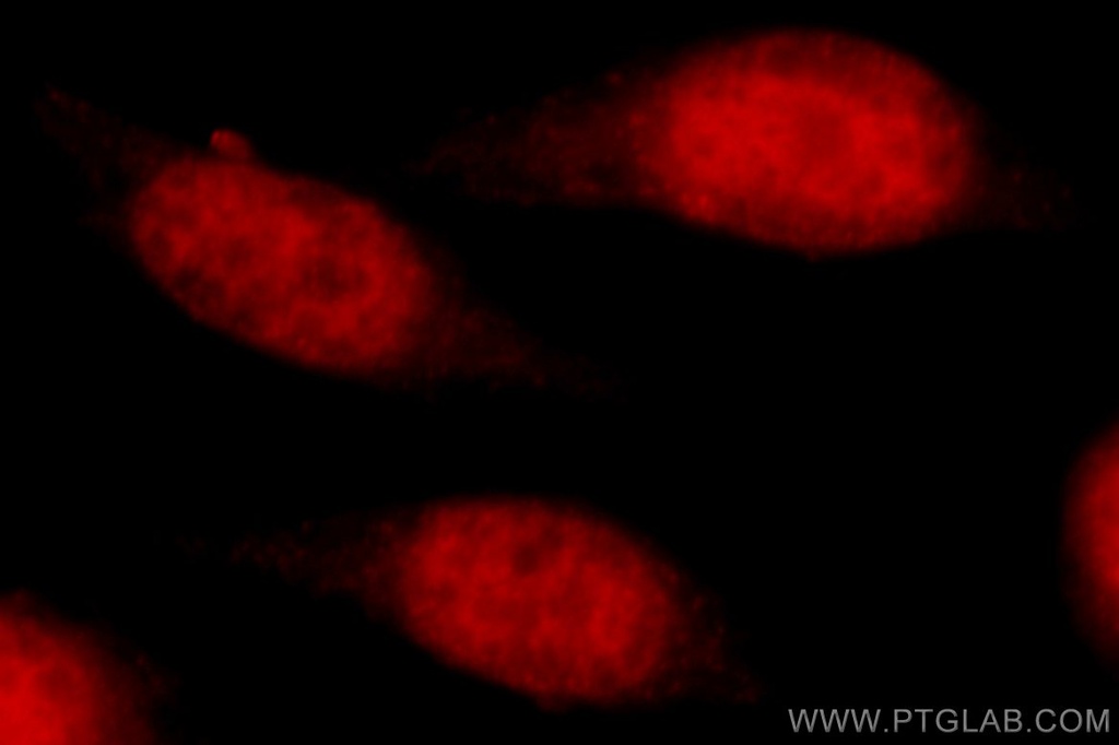 TBP Polyclonal antibody
