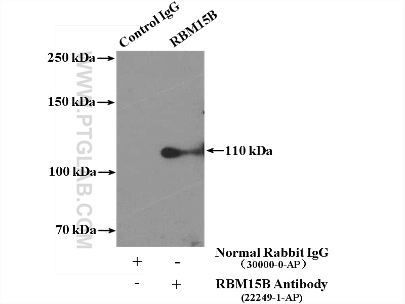 RBM15B Polyclonal antibody