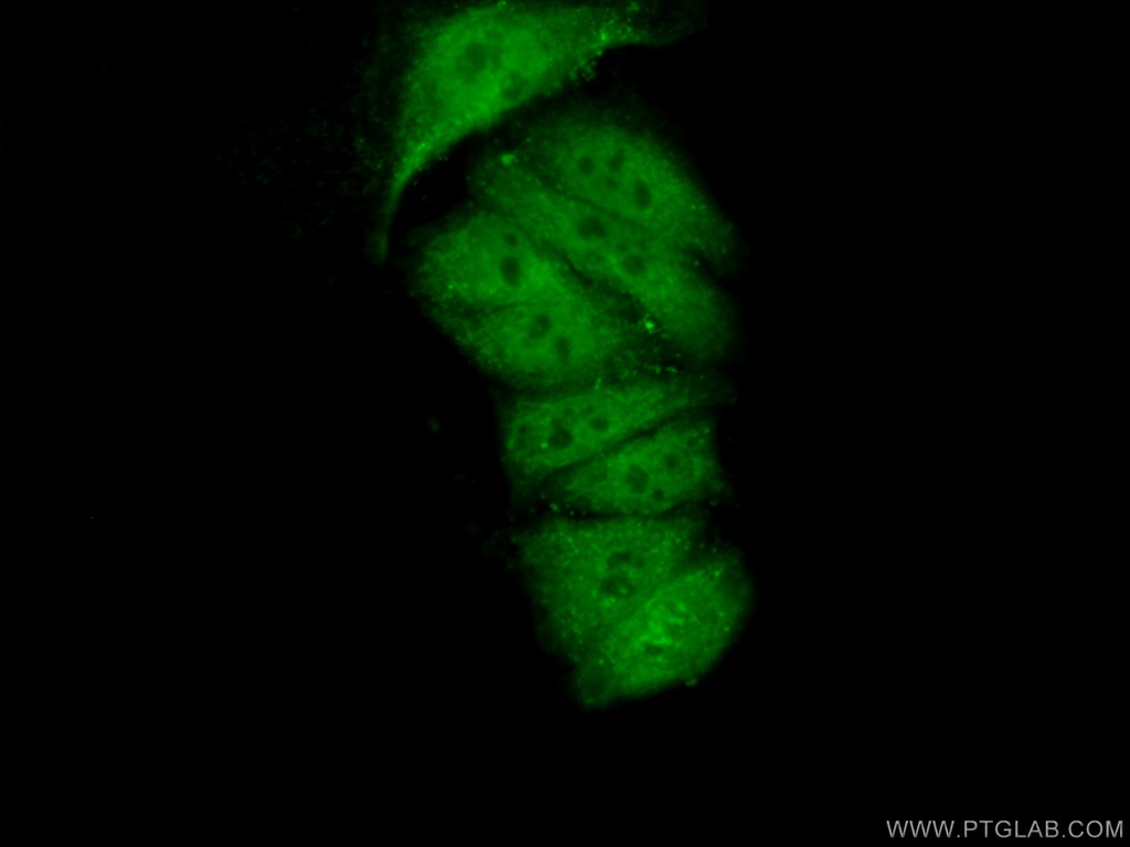 FAM98B Polyclonal antibody