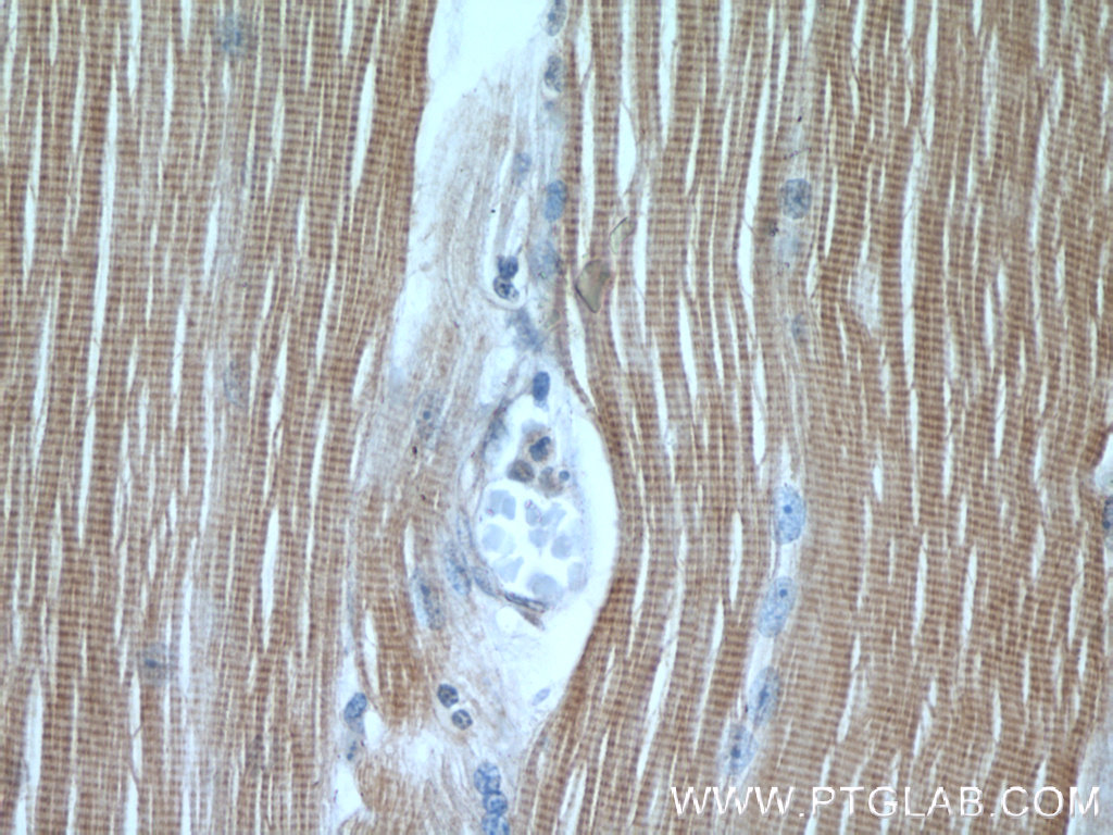 TNNI1 Polyclonal antibody