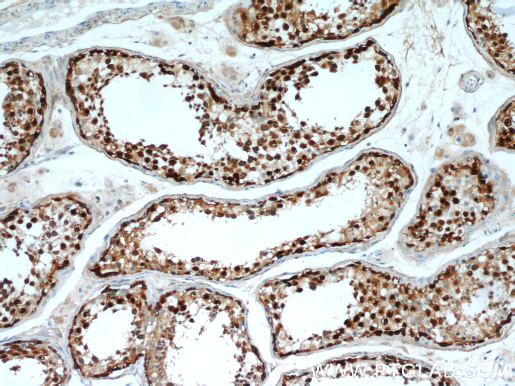 TSPY3 Polyclonal antibody