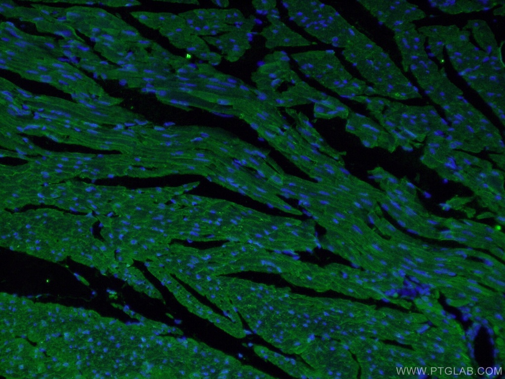 MYH7-specific Polyclonal antibody