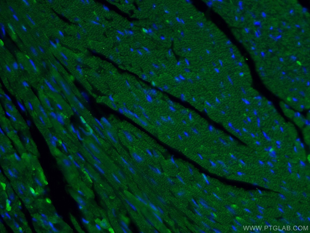 MYH6 Polyclonal antibody