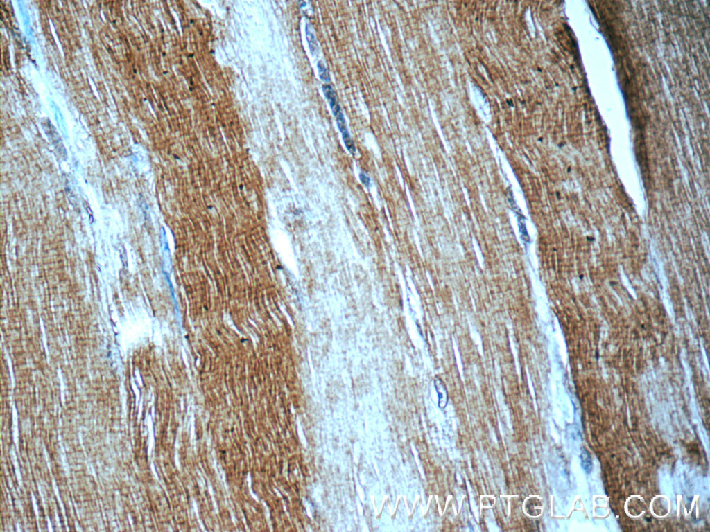 MYH1-motor domain Polyclonal antibody