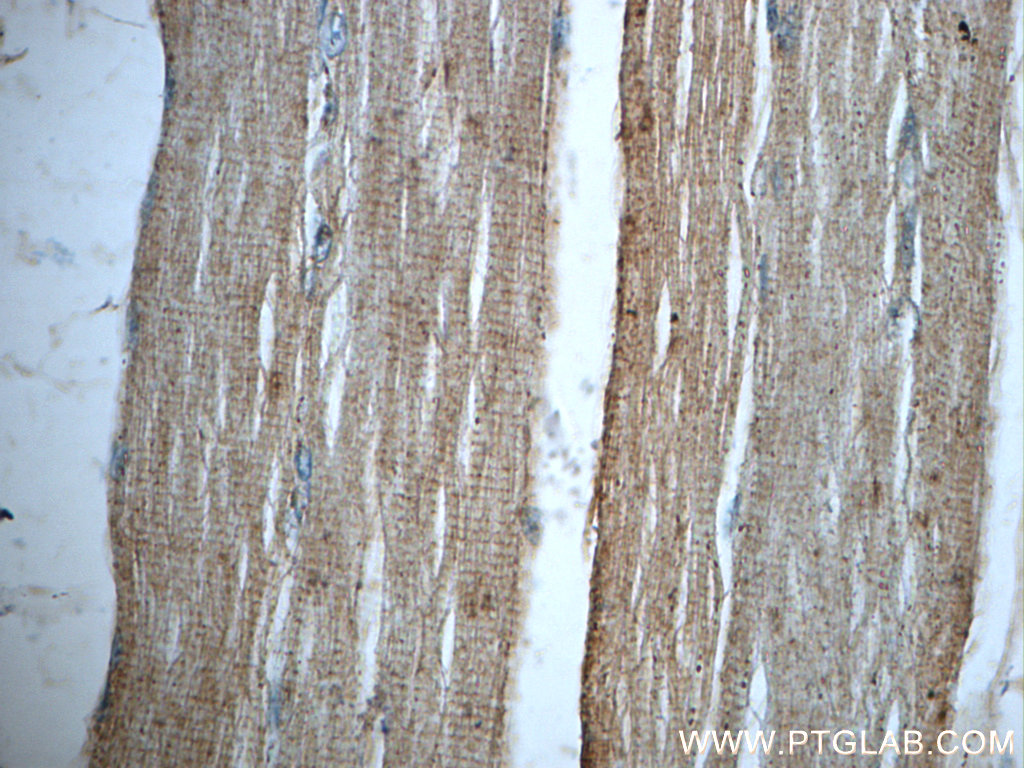 SAR1A Polyclonal antibody