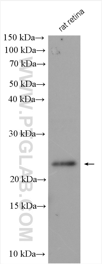 GCAP2 Polyclonal antibody
