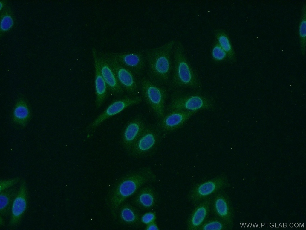 RCC1 Polyclonal antibody