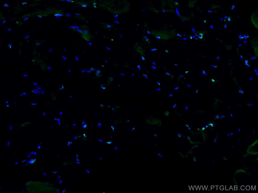 TCF4 Polyclonal antibody