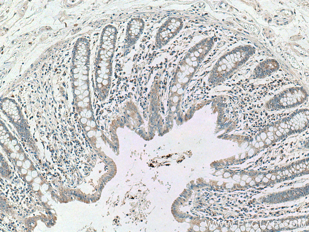 CCL17 Polyclonal antibody