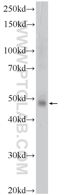 GATA3 Polyclonal antibody