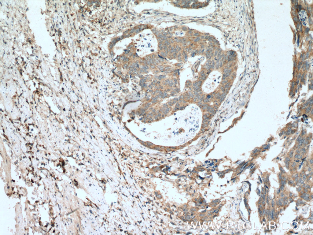 MIG Polyclonal antibody