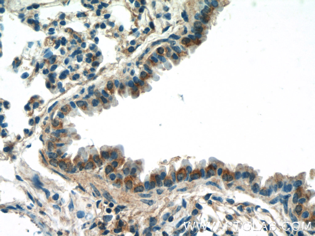 DCP1A Polyclonal antibody