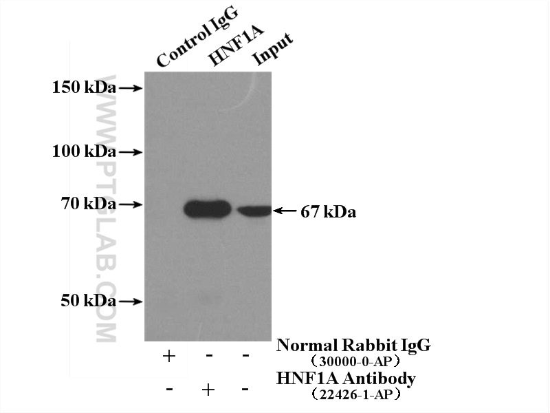 HNF1A Polyclonal antibody