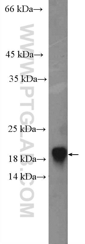 GABARAP Polyclonal antibody