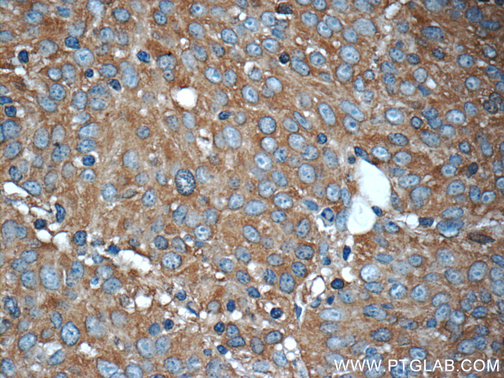 PKLR Polyclonal antibody