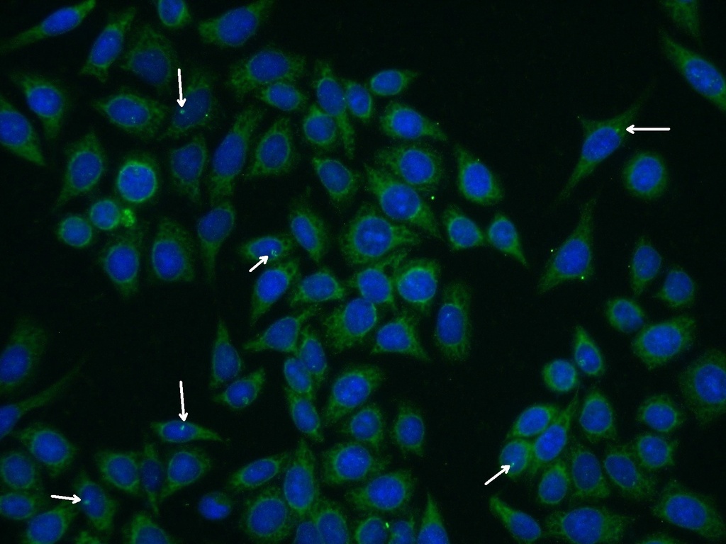 CEP290 Polyclonal antibody