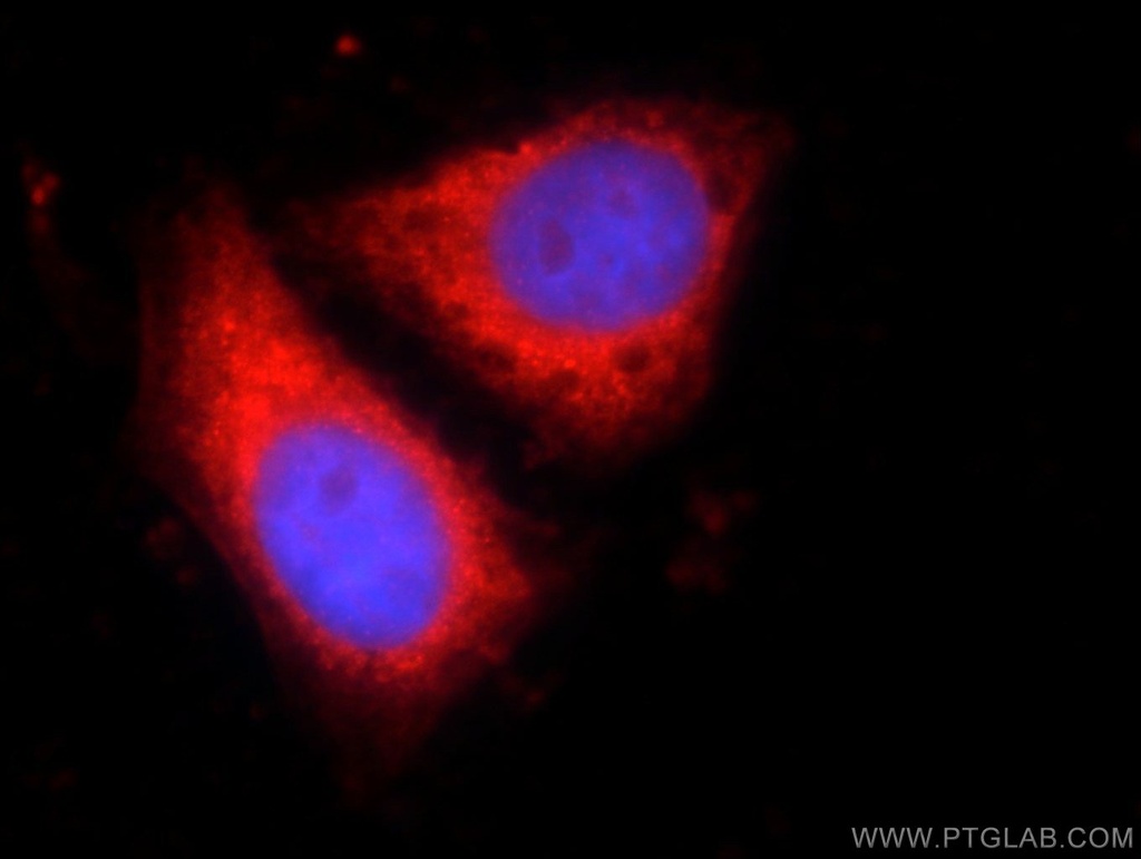 CNOT9 Polyclonal antibody