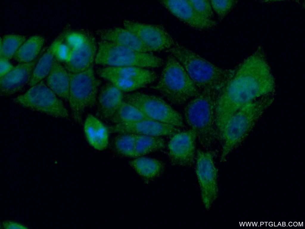 AIRE Polyclonal antibody
