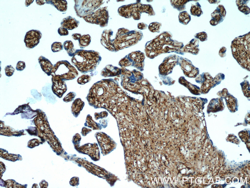 HPGDS Polyclonal antibody