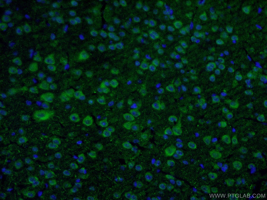 DAT Polyclonal antibody