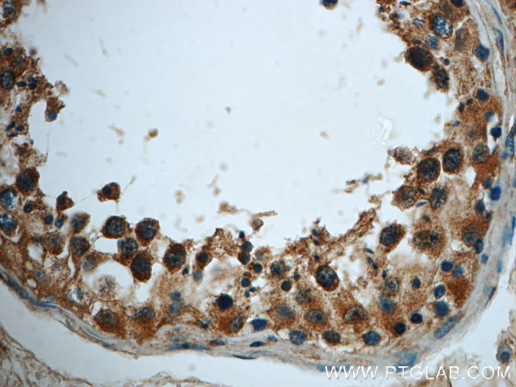 TMEM168 Polyclonal antibody