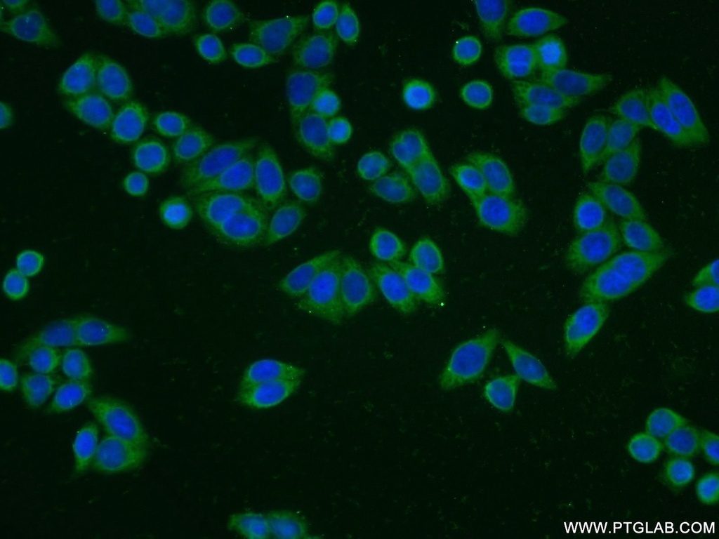 WDR61 Polyclonal antibody