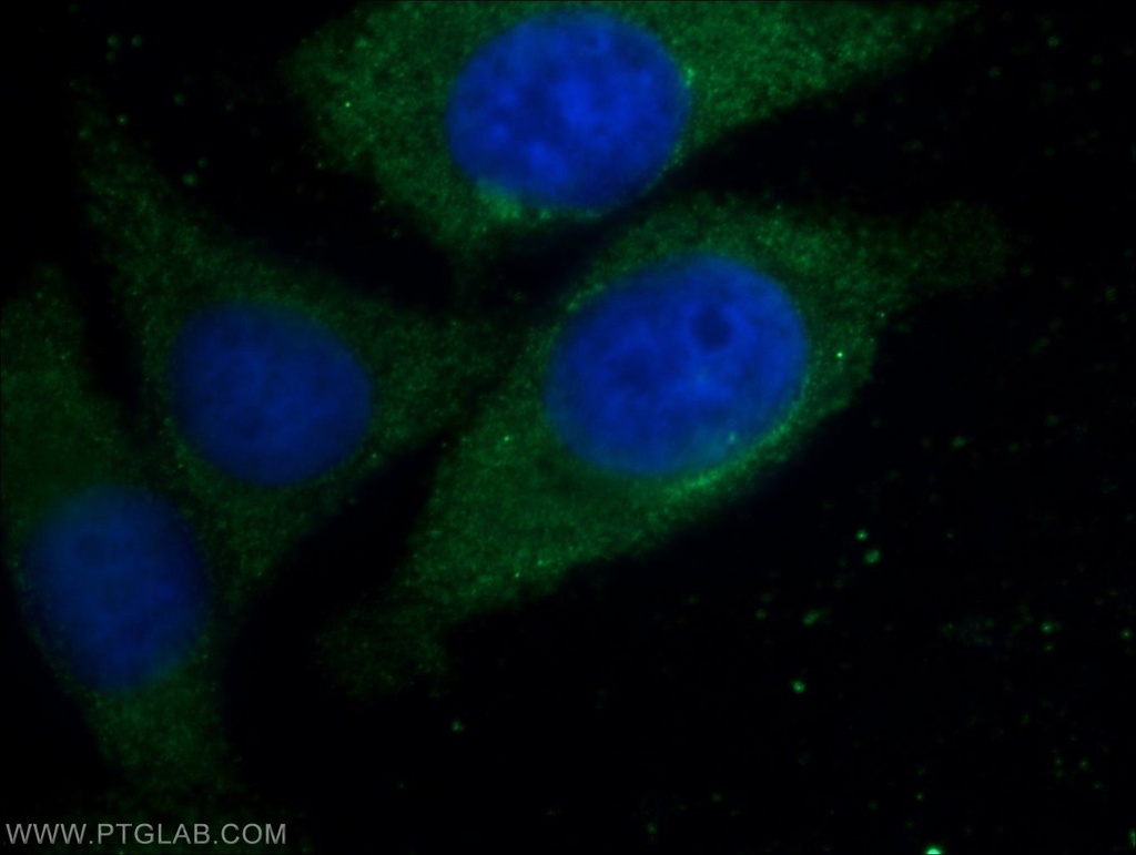 GAB2 Polyclonal antibody