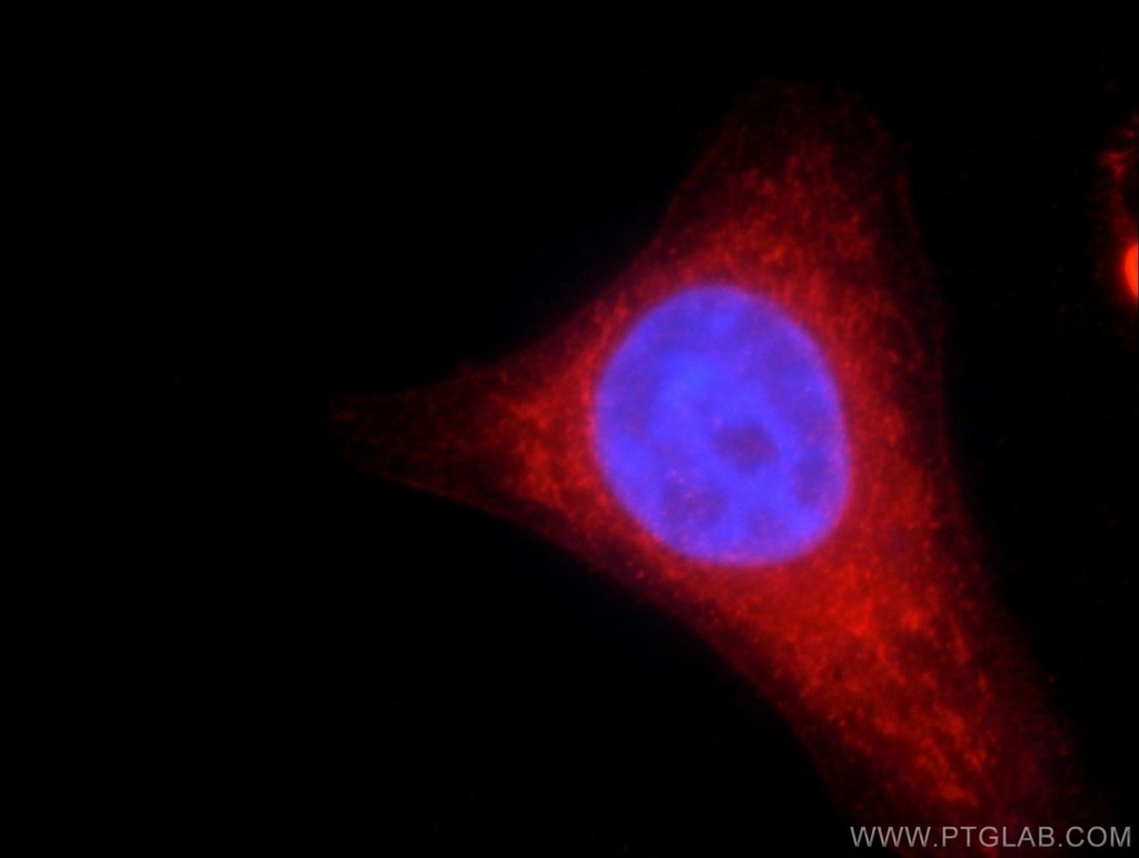 RNASEL Polyclonal antibody