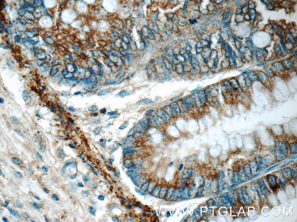 ARAP3 Polyclonal antibody