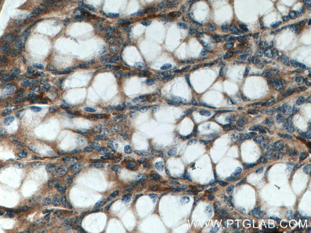 TFAM Polyclonal antibody