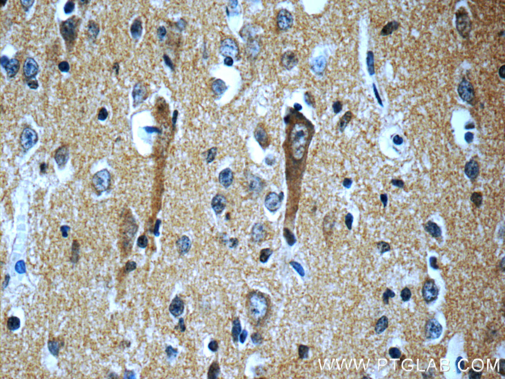 SORLA Polyclonal antibody