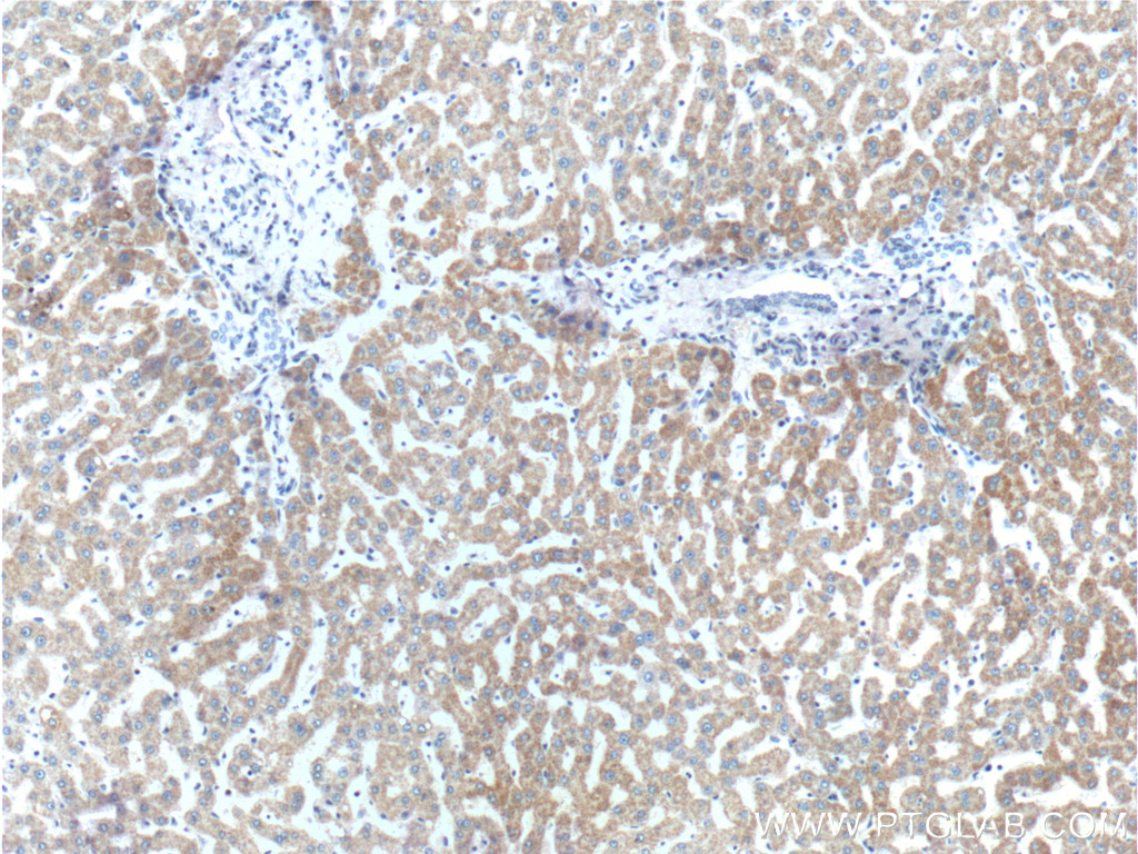 FNDC3B Polyclonal antibody