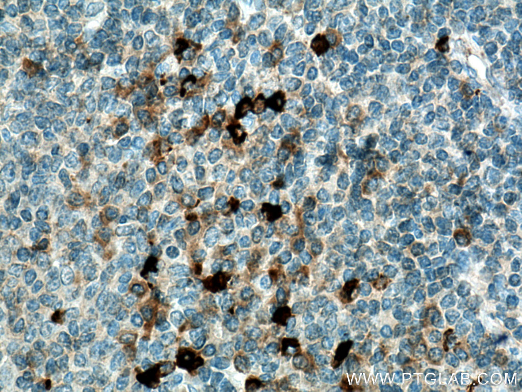IL-28A Polyclonal antibody