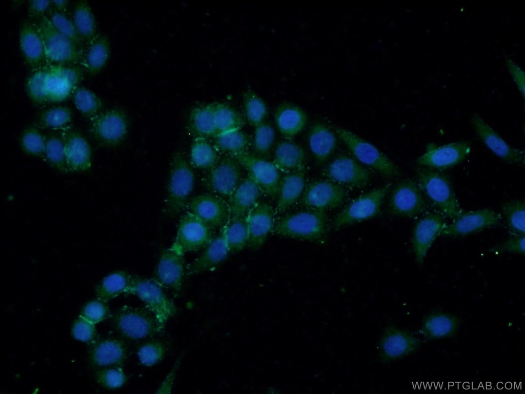 EYA1 Polyclonal antibody