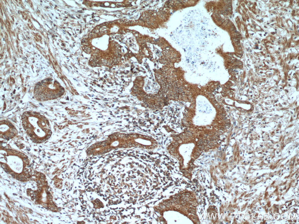 A4GNT Polyclonal antibody