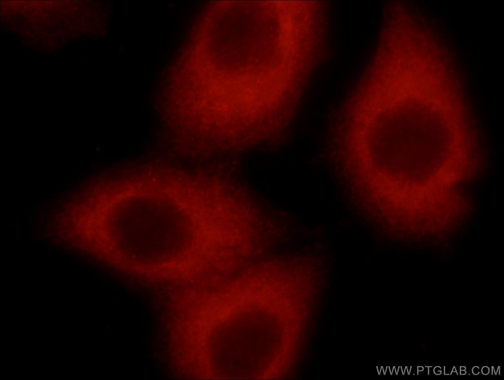 STARS/ABRA Polyclonal antibody