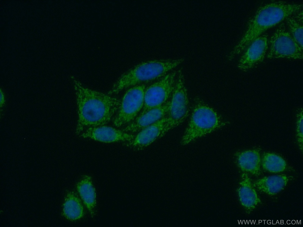 PPP4R2 Polyclonal antibody
