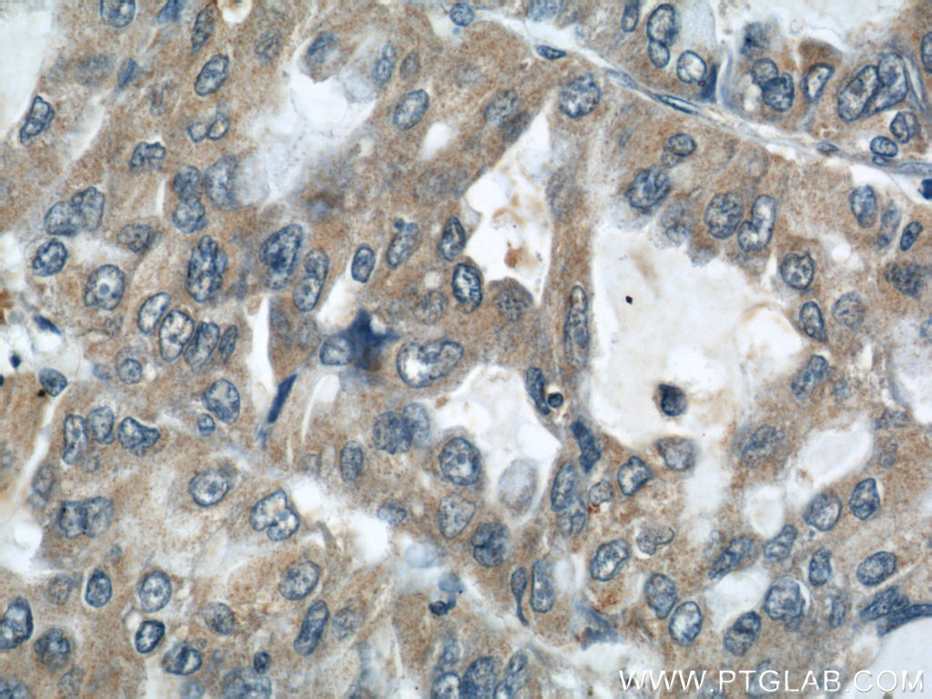 AARS2 Polyclonal antibody