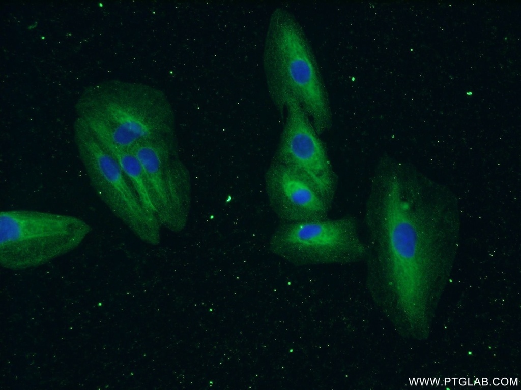 EML4 Polyclonal antibody