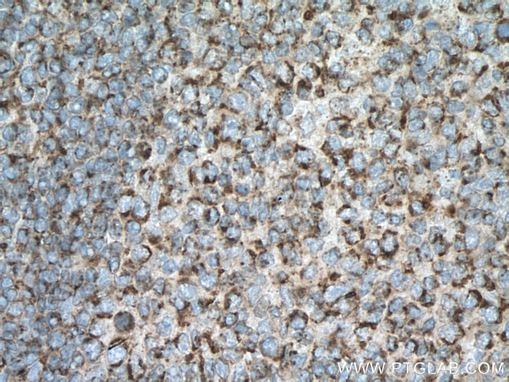SLAMF6 Polyclonal antibody