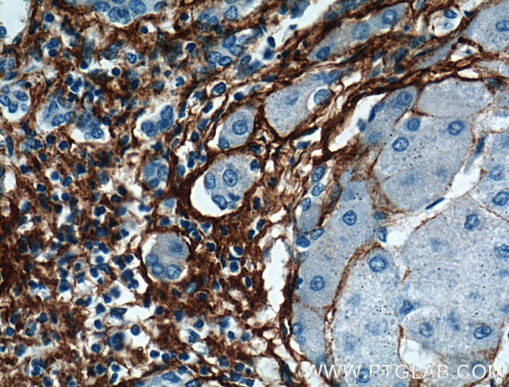 Collagen Type III (N-terminal) Polyclonal antibody