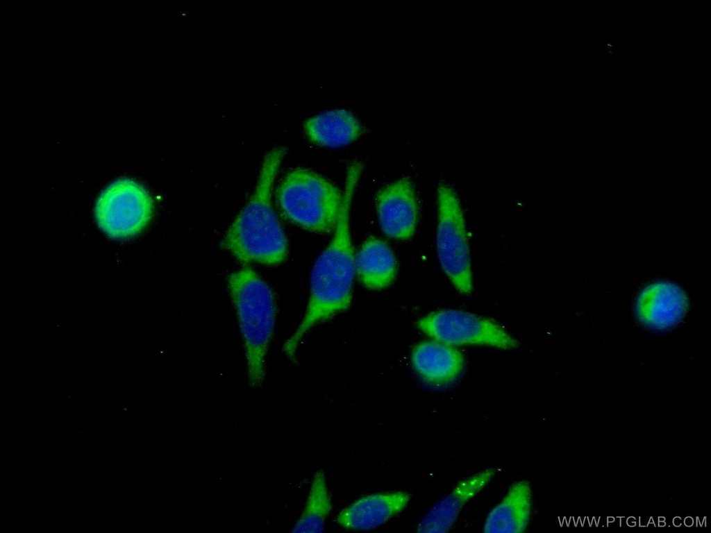 GDEP Polyclonal antibody