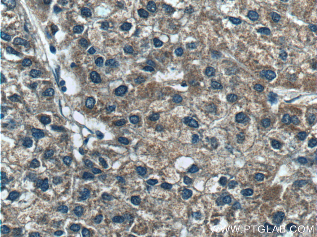 SARDH Polyclonal antibody