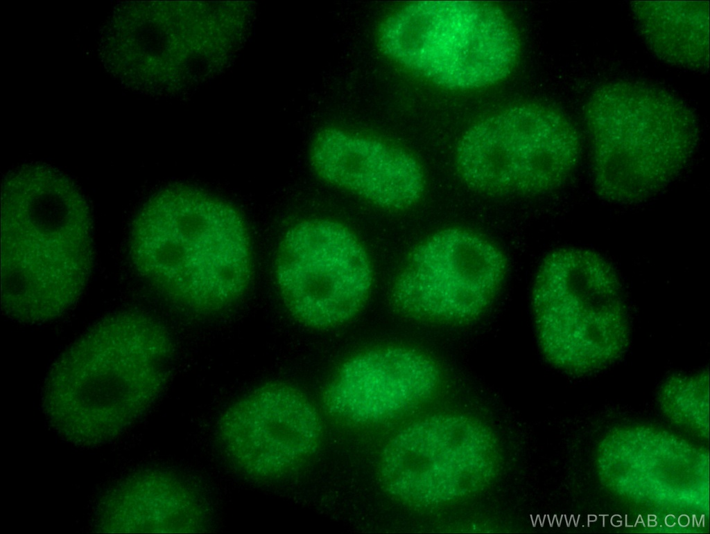 UBR5 Polyclonal antibody