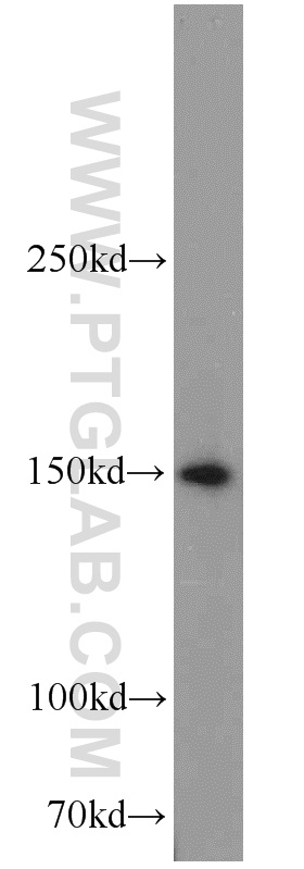 SAMD9 Polyclonal antibody