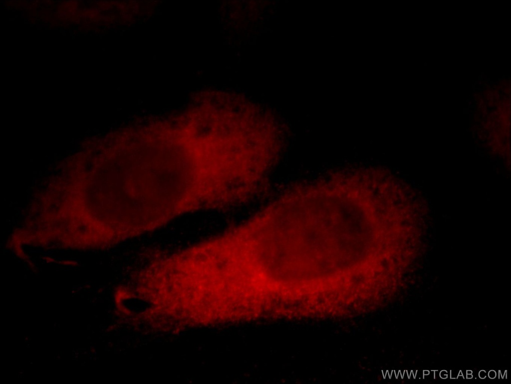 PHLPP Polyclonal antibody