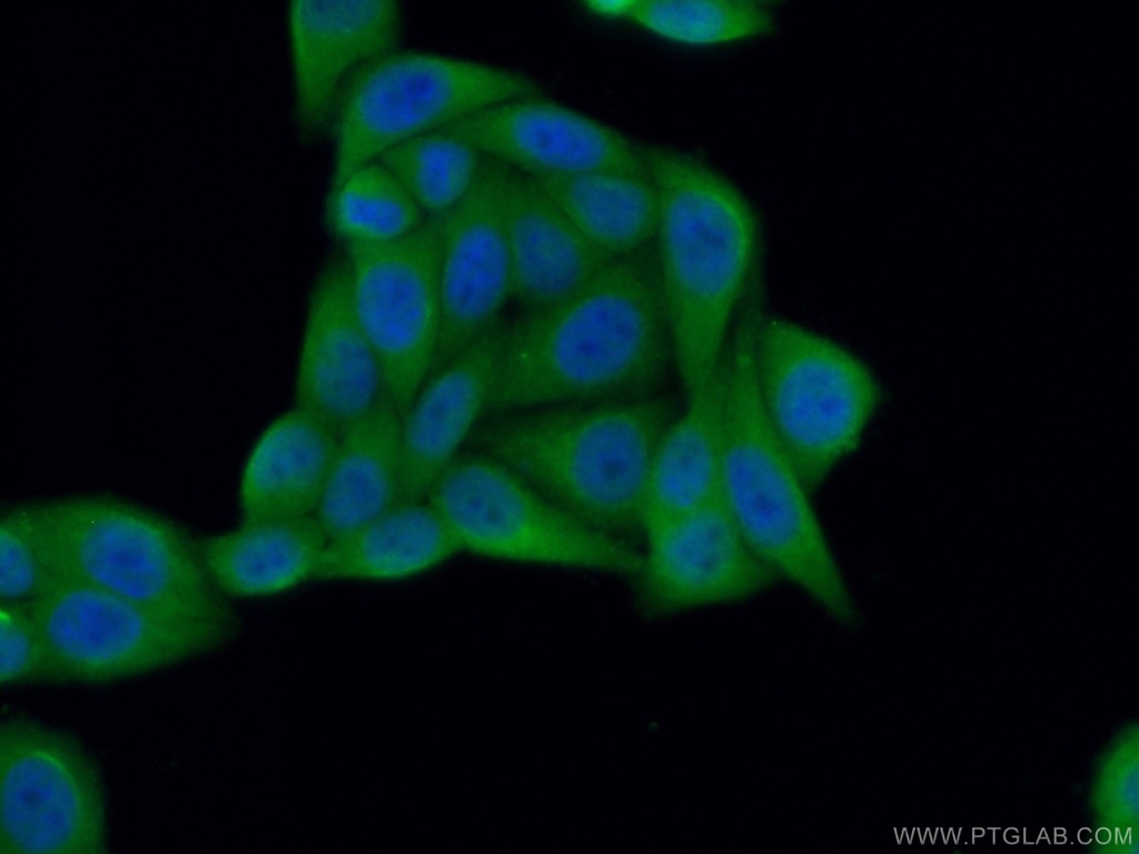 CCS Polyclonal antibody