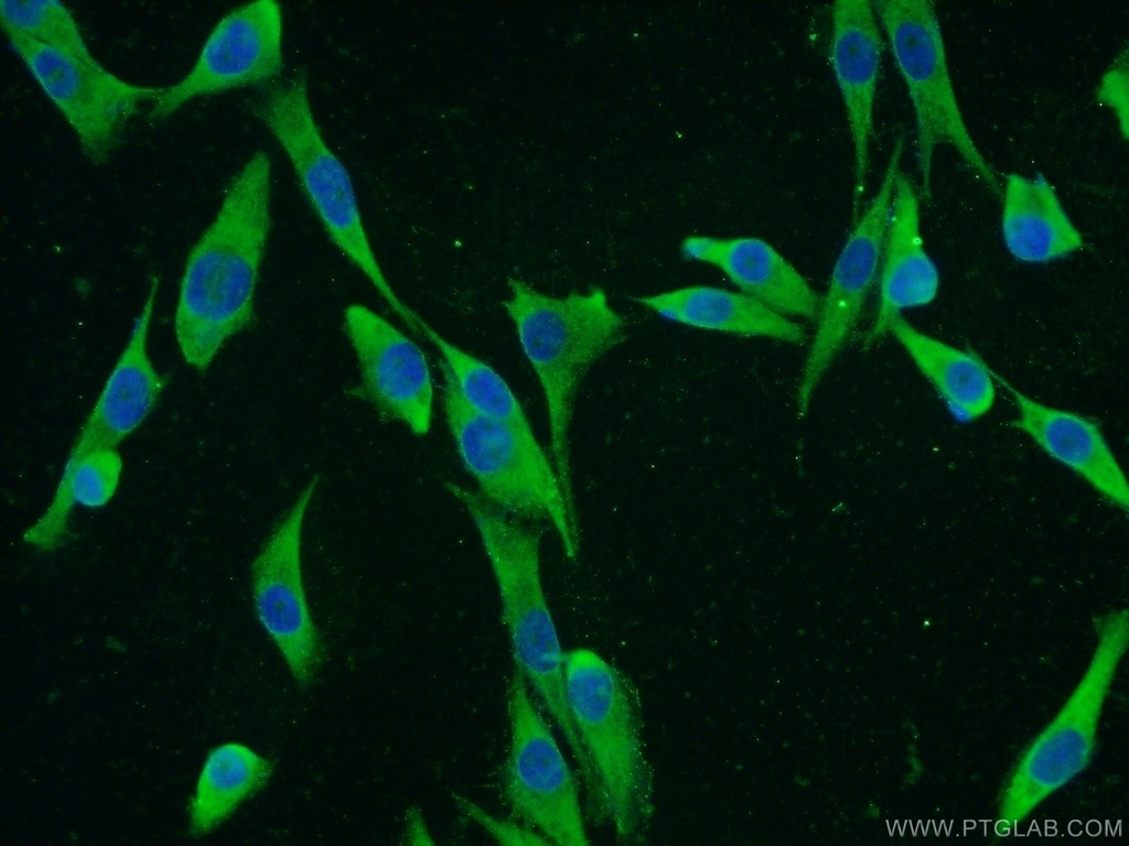 IGF2BP1 Polyclonal antibody