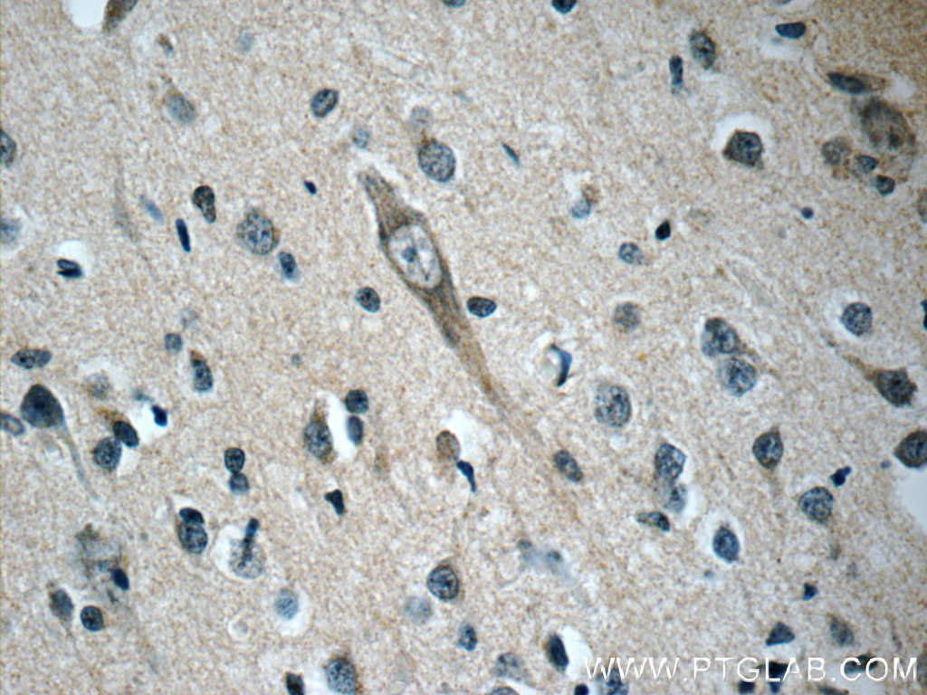 OFD1 Polyclonal antibody
