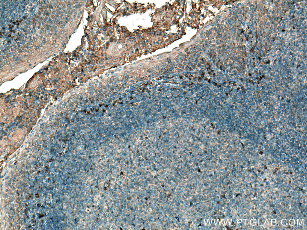 IL-31 Polyclonal antibody
